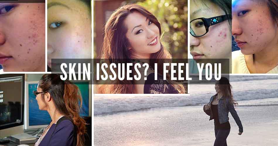 Banish skincare banner