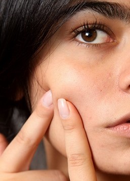 Woman Pinching Blemish