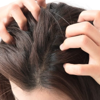 10 Top Shampoo Options for an Itchy Scalp