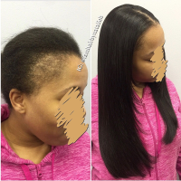 Natural Hairstyles With Thin Edges