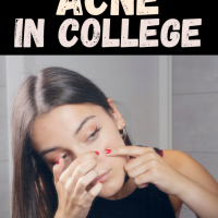 Preventing Acne in College: A CF Survival Guide