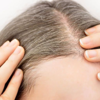 Best Tips To Get Rid Of White Hairs